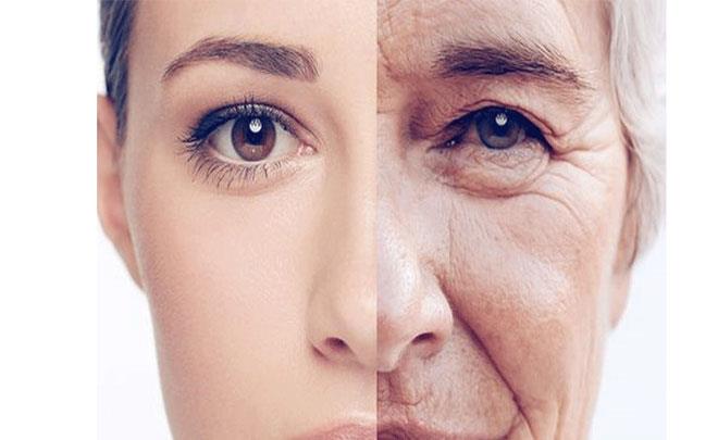 ‌هۆکارەکانی کەمبوونەوەی کۆلاجین چین ؟